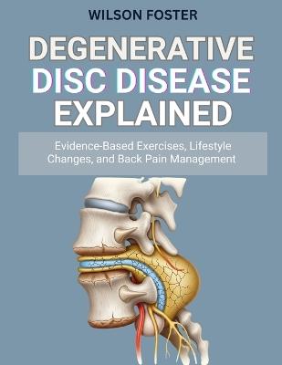 Degenerative Disc Disease Explained: Evidence-Based Exercises, Lifestyle Changes, and Back Pain Management - Wilson Foster - cover