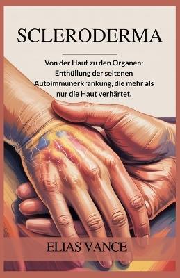 Scleroderma: Von der Haut zu den Organen: Enthüllung der seltenen Autoimmunerkrankung, die mehr als nur die Haut verhärtet. - Elias Vance - cover
