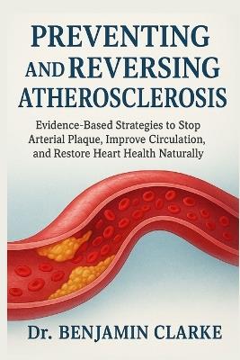 Preventing and Reversing Atherosclerosis: Evidence-Based Strategies to Stop Arterial Plaque, Improve Circulation, and Restore Heart Health Naturally - Benjamin Clarke - cover