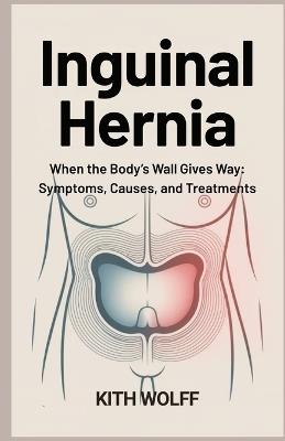 Inguinal Hernia: When the Body's Wall Gives Way: Symptoms, Causes, and Treatments - Kith Wolff - cover