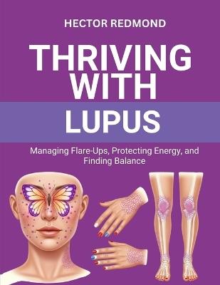 Thriving with Lupus: Managing Flare-Ups, Protecting Energy, and Finding Balance - Hector Redmond - cover