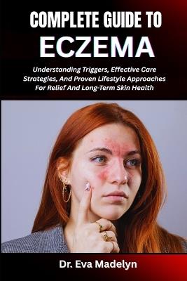 Complete Guide to Eczema: Understanding Triggers, Effective Care Strategies, And Proven Lifestyle Approaches For Relief And Long-Term Skin Health - Eva Madelyn - cover