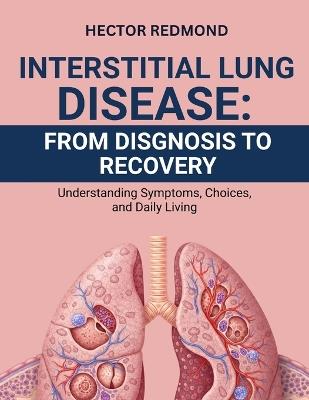 Interstitial Lung Disease: From Diagnosis to Recovery: Understanding Symptoms, Choices, and Daily Living - Hector Redmond - cover