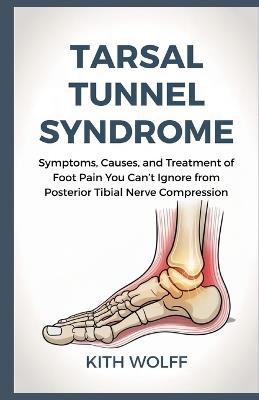 Tarsal Tunnel Syndrome: Symptoms, Causes, and Treatment of Foot Pain You Can't Ignore from Posterior Tibial Nerve Compression - Kith Wolff - cover