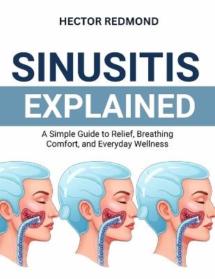 Sinusitis Explained: A Simple Guide to Relief, Breathing Comfort, and Everyday Wellness - Hector Redmond - cover