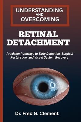 Understanding and Overcoming Retinal Detachment: Precision Pathways to Early Detection, Surgical Restoration, and Visual System Recovery - Fred G Clement - cover