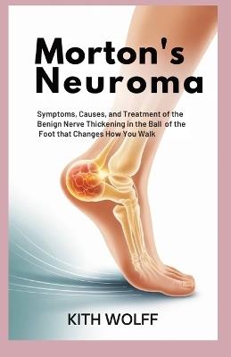 Morton's Neuroma: Symptoms, Causes, and Treatment of the Benign Nerve Thickening in the Ball of the Foot That Changes How You Walk - Kith Wolff - cover