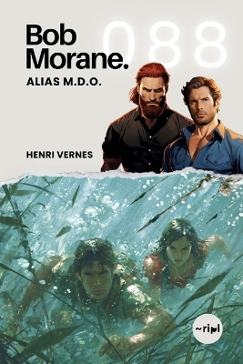 ibs