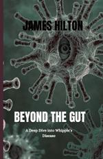 Beyond the Gut: A Deep Dive into Whipple's Disease