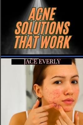 Acne Solutions That Work: Proven Skin Treatments, Skincare Tips, And Natural Remedies For Lasting Results - Jace Everly - cover