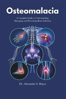 Osteomalacia: A Complete Guide to Understanding, Managing, and Preventing Bone Softening - Alexander S Hayes - cover