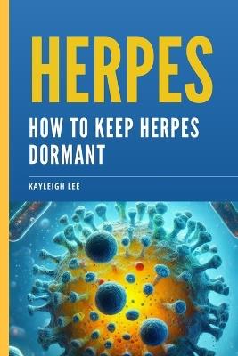Herpes: How To Keep Herpes Dormant: Herpes Book - Kayleigh Lee - cover