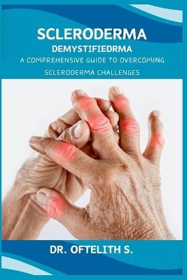 Scleroderma Demystified: A Comprehensive Guide to Overcoming Scleroderma Challenges - Oftelith S - cover