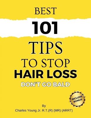 Best 101 Tips to Stop Hair Loss - Charles Young - cover