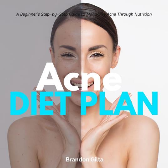 Acne Diet Plan