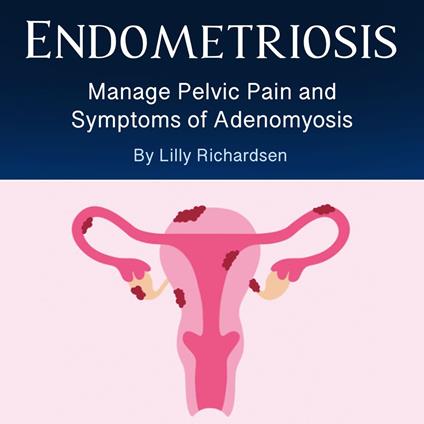 Endometriosis