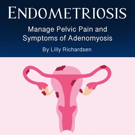 Endometriosis