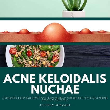 Acne Keloidalis Nuchae