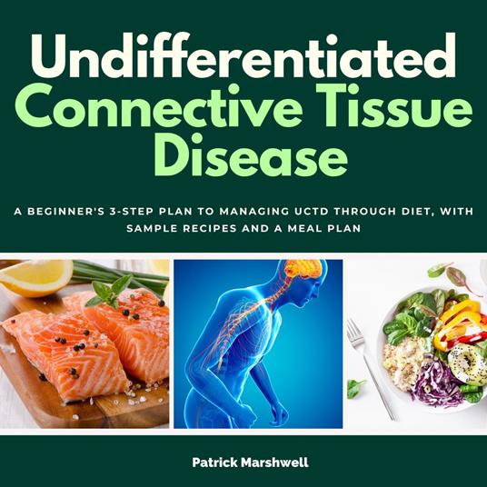 Undifferentiated Connective Tissue Disease