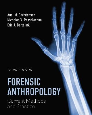 Forensic Anthropology: Current Methods and Practice - Angi M. Christensen,Nicholas V. Passalacqua,Eric J. Bartelink - cover