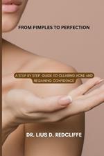 From Pimples to Perfection: A Step by Step Guide to Clearing Acne and Regaining Confidence