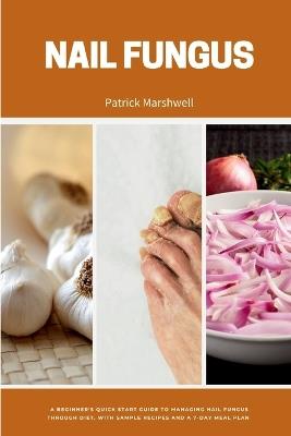 Nail Fungus: A Beginner's Quick Start Guide to Managing Nail Fungus Through Diet, With Sample Recipes and a 7-Day Meal Plan - Patrick Marshwell - cover