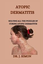 Atopic Dermatitis: Solving All the Puzzles of Curing Atopic Dermatitis