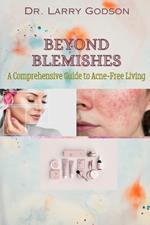 Beyond Blemishes: A Comprehensive Guide to Acne-Free Living/ Skincare Bible for Radiant Skin