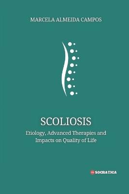 Scoliosis: Etiology, Advanced Therapies and Impacts on Quality of Life - Marcela Almeida Campos - cover