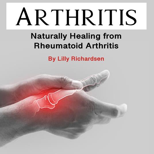 Arthritis