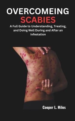 Overcomeing Scabies: A Full Guide to Understanding, Treating, and Doing Well During and After an Infestation - Cooper L Miles - cover