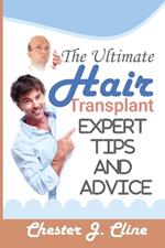 The Ultimate Hair Transplant Guide: An Expert book for Perfect Results: The Ultimate Guide to Hair Transplants: Expert Tips and Advice