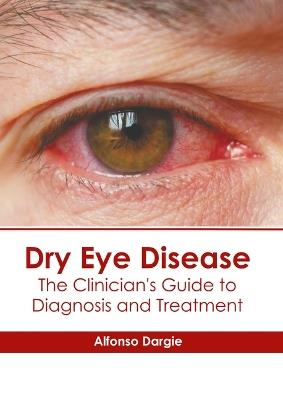 Dry Eye Disease: The Clinician's Guide to Diagnosis and Treatment - cover