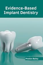 Evidence-Based Implant Dentistry