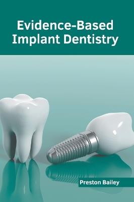 Evidence-Based Implant Dentistry - cover