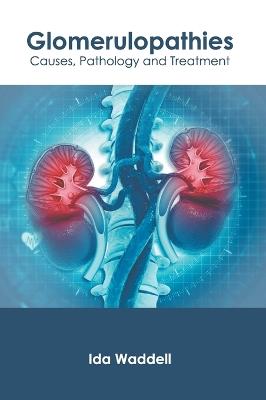 Glomerulopathies: Causes, Pathology and Treatment - cover