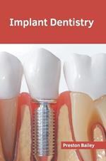 Implant Dentistry