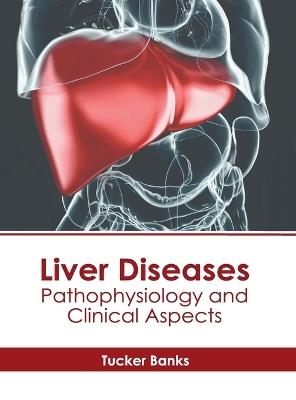 Liver Diseases: Pathophysiology and Clinical Aspects - cover