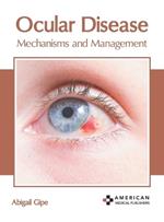 Ocular Disease: Mechanisms and Management