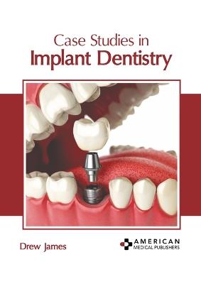 Case Studies in Implant Dentistry - cover