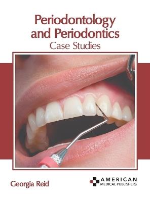Periodontology and Periodontics: Case Studies - cover
