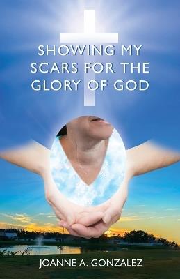 Showing My Scars for the Glory of God - Joanne Gonzalez - cover