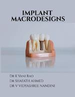 Implant Macrodesigns
