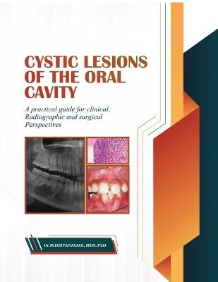 Cystic Lesions of the Oral Cavity: A Practical Guide for Clinical, Radiographic and Surgical Perspectives - Dr Deivanayagi M - cover