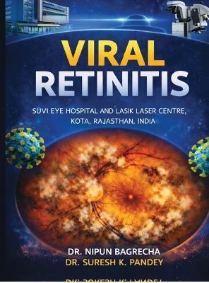Viral Retinitis - Dr Nipun Bagrecha - cover